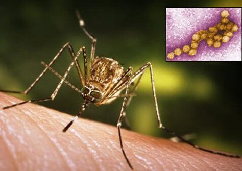 west-nile-fever