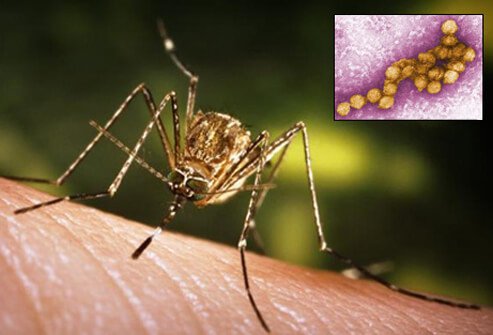 west-nile-fever