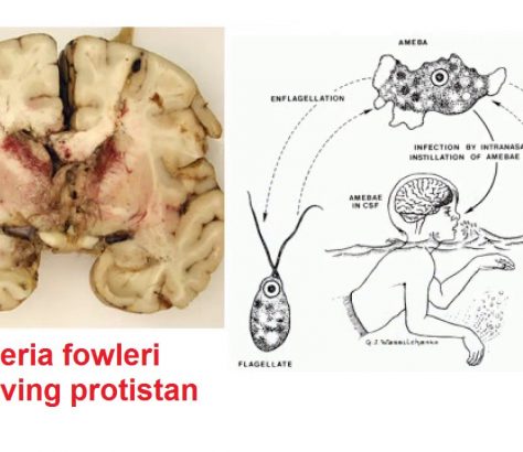 naegleria-fowleri