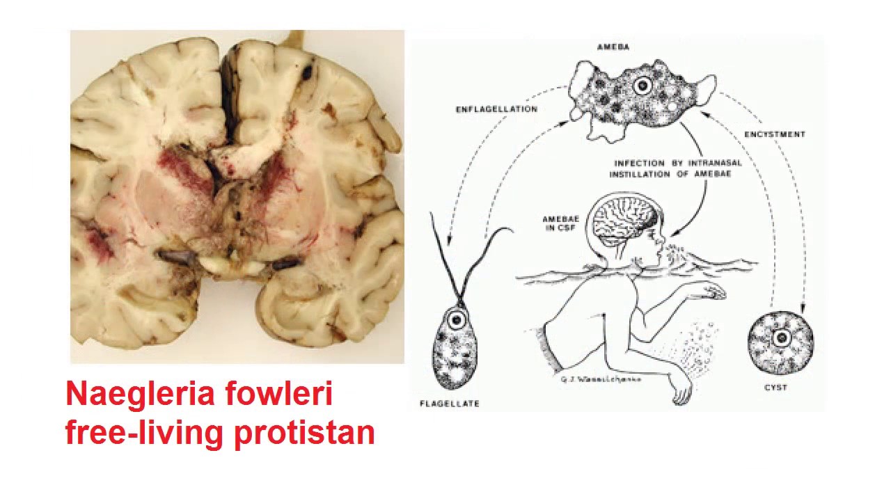 naegleria-fowleri