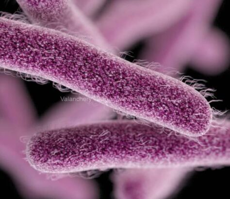 Shigella