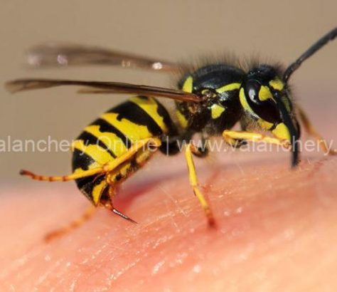 wasp-sting