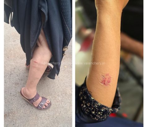 dog-bite-valanchery-oct-2025