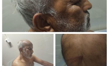 asharaf-assault-edayur