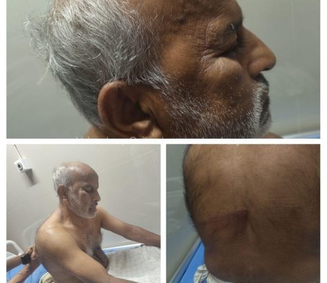 asharaf-assault-edayur