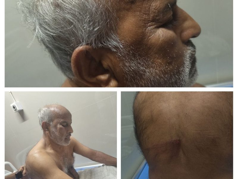 asharaf-assault-edayur